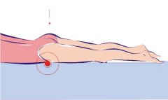 Kegel exercises